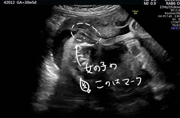 30w5d 妊娠8カ月 妊婦検診7回目 検診内容や赤ちゃんの体重は メモらねばー